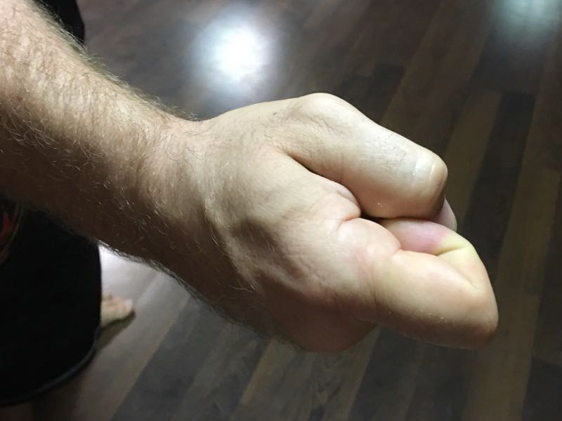 Phoenix Eye Fist right outside